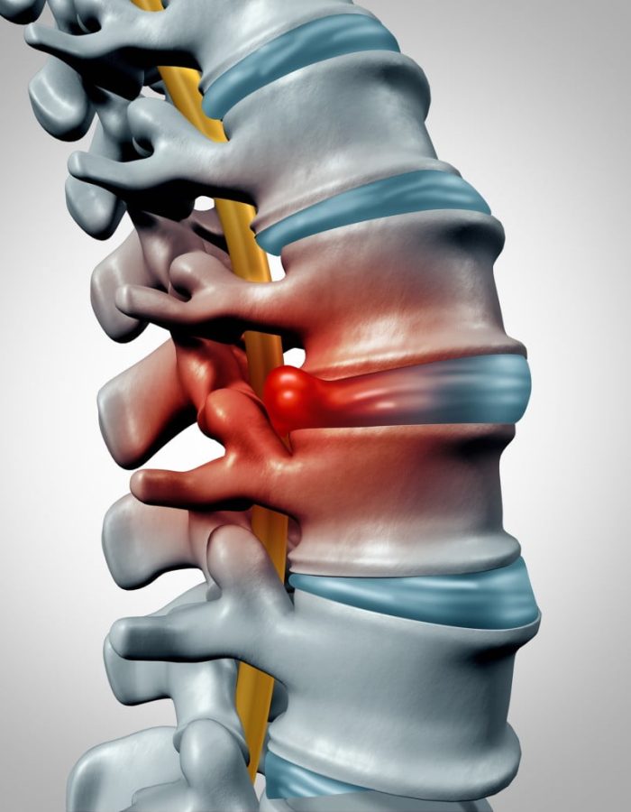 iStock-502528790-1024×1024 iStock-502528790-1024x1024